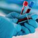 Colorectal cancer screening guidelines updated to include blood test for the first time