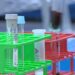 Washington State Patrol battles toxicology backlog